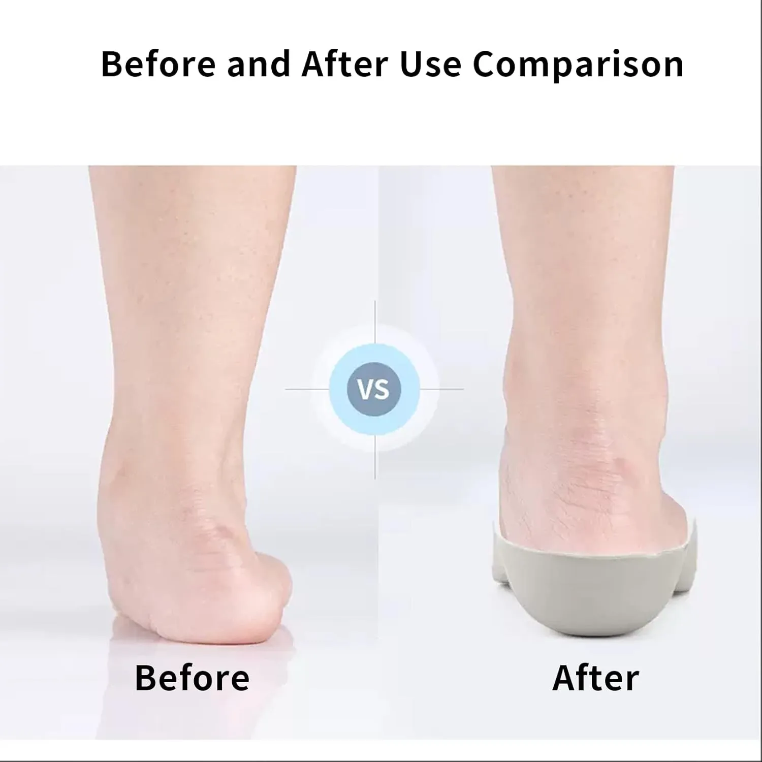 Children's Orthopedic Insoles,Kids Orthotics Inserts Provides Arch Support for Flat Foot,Breathable and Non-Slip