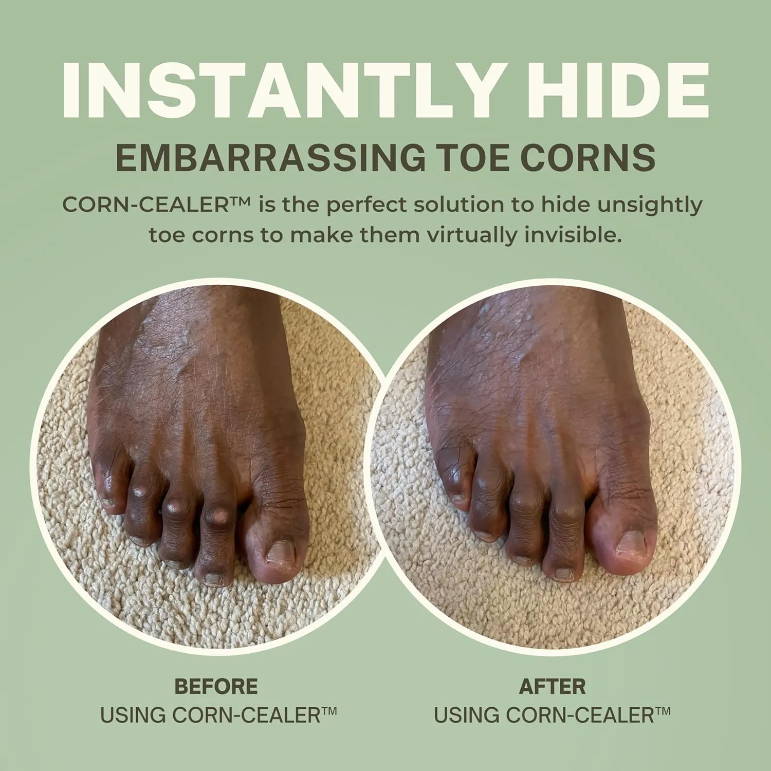 is A Toe Corn Makeup That Instantly Hides Toe Corns | Water-Resistant | Foot Care | Body and Scar Blemishes | Tattoo Cover up | Gifts for Her (CHESTNUT)