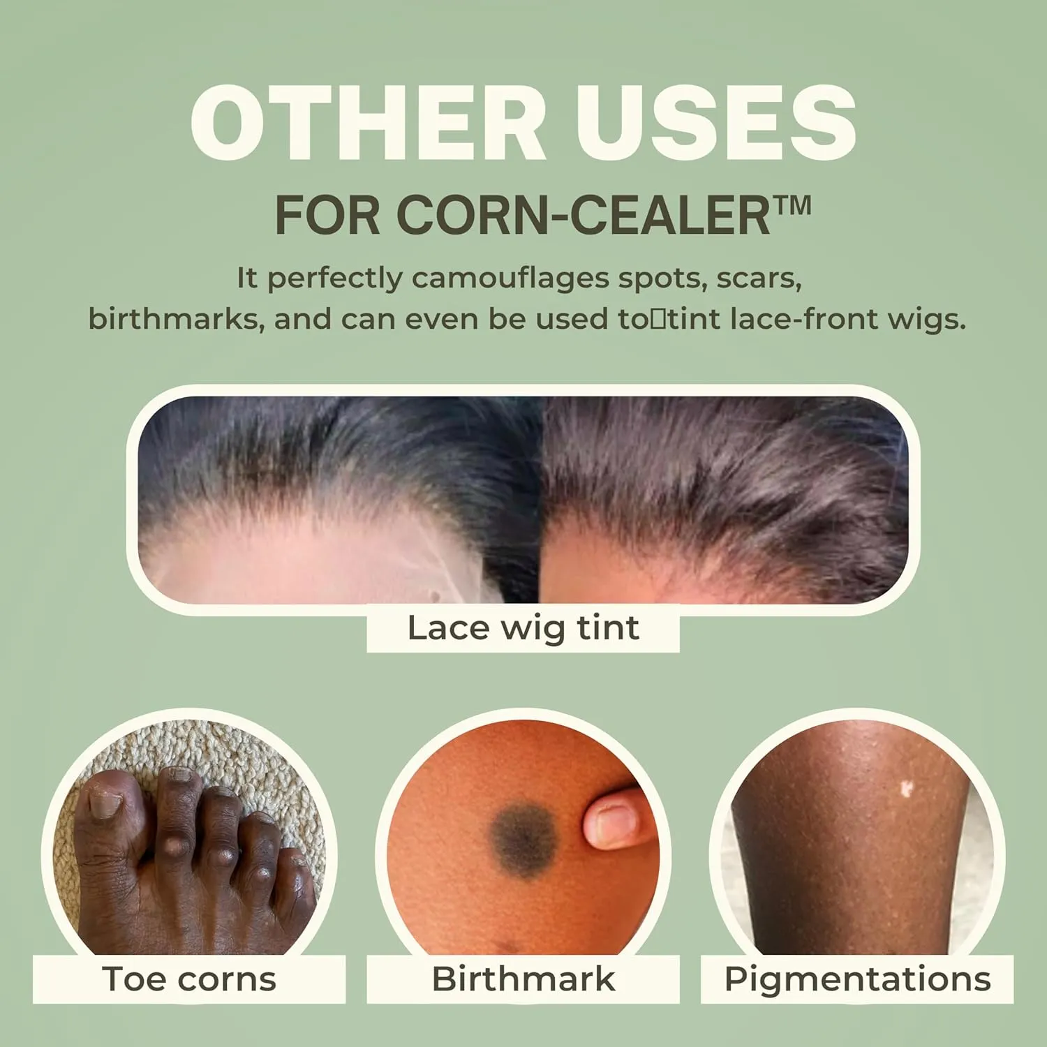 is A Toe Corn Makeup That Instantly Hides Toe Corns | Water-Resistant | Foot Care | Body and Scar Blemishes | Tattoo Cover up | Gifts for Her (CHESTNUT)
