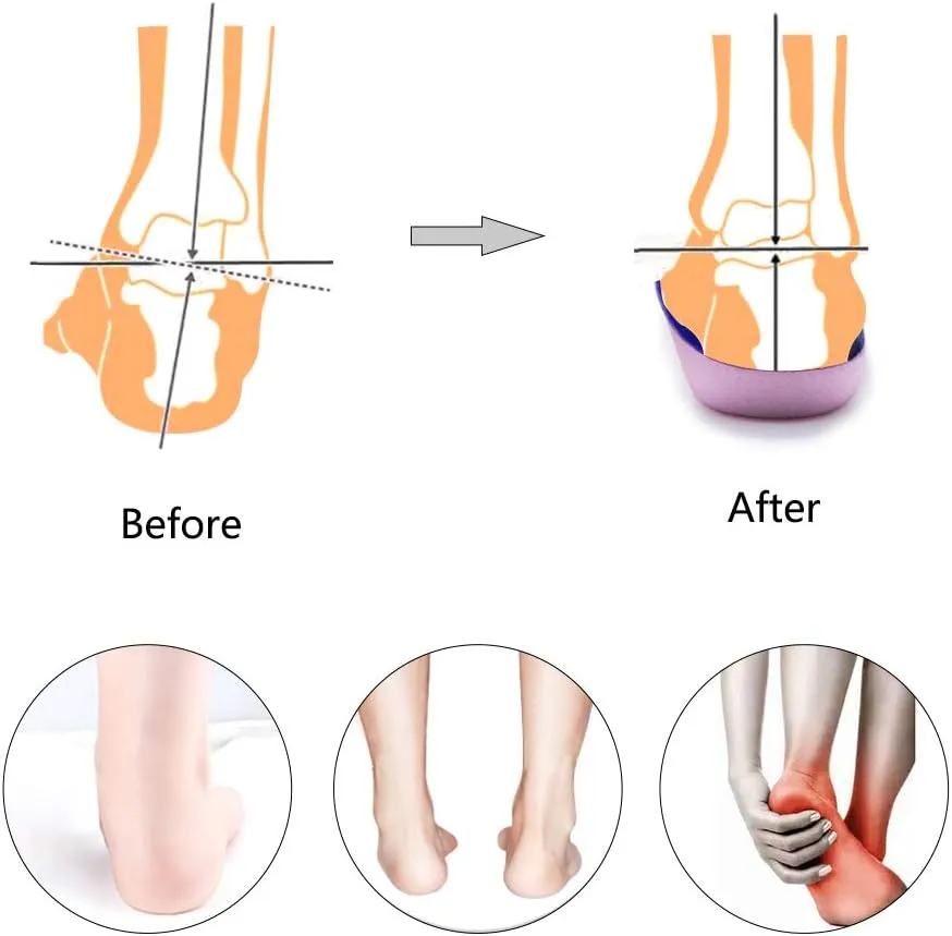 PCSsole’s 3/4 Orthotics Shoe Insoles High Arch Supports Shoe Insoles for Plantar Fasciitis, Flat Feet, Over-Pronation, Relief Heel Spur Pain